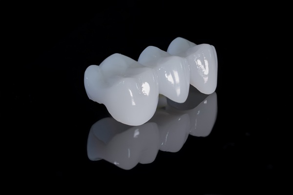 Tooth Replacement    : Why A Dentist May Recommend A Dental Bridge