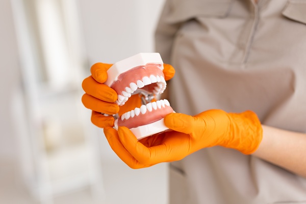 How Long Does It Take To Get Implant Supported Dentures?