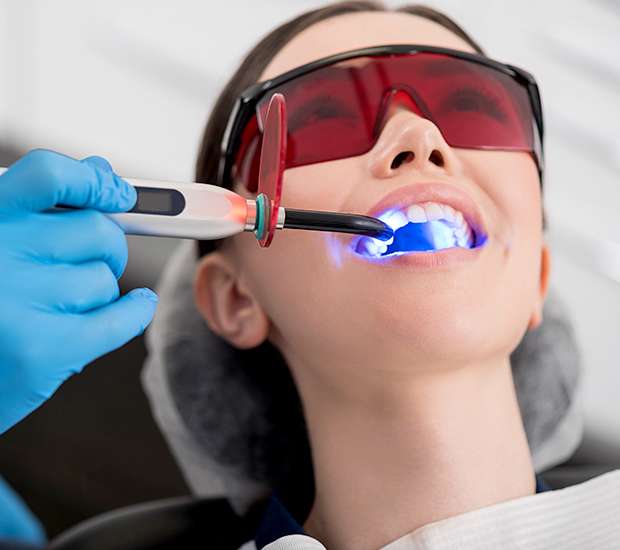 Knoxville Professional Teeth Whitening