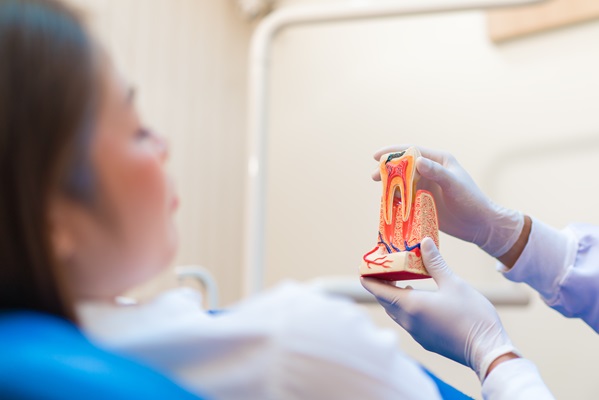 What To Expect During Root Canal Therapy